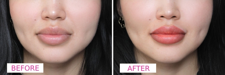 Lip-Blush