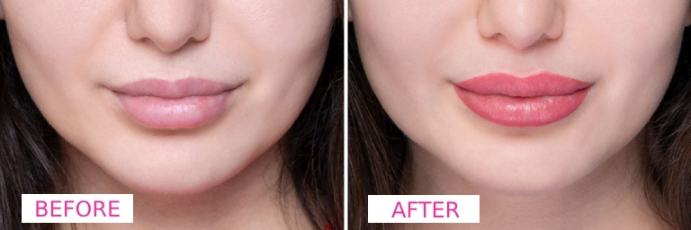 Lip-Blush