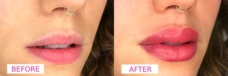 Lip-Blush